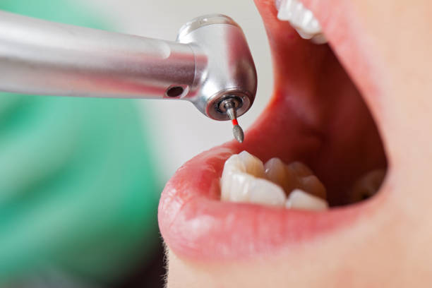Best Root Canal Emergency Dentist  in Sonterra, TX